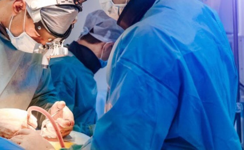 Hysterectomy
